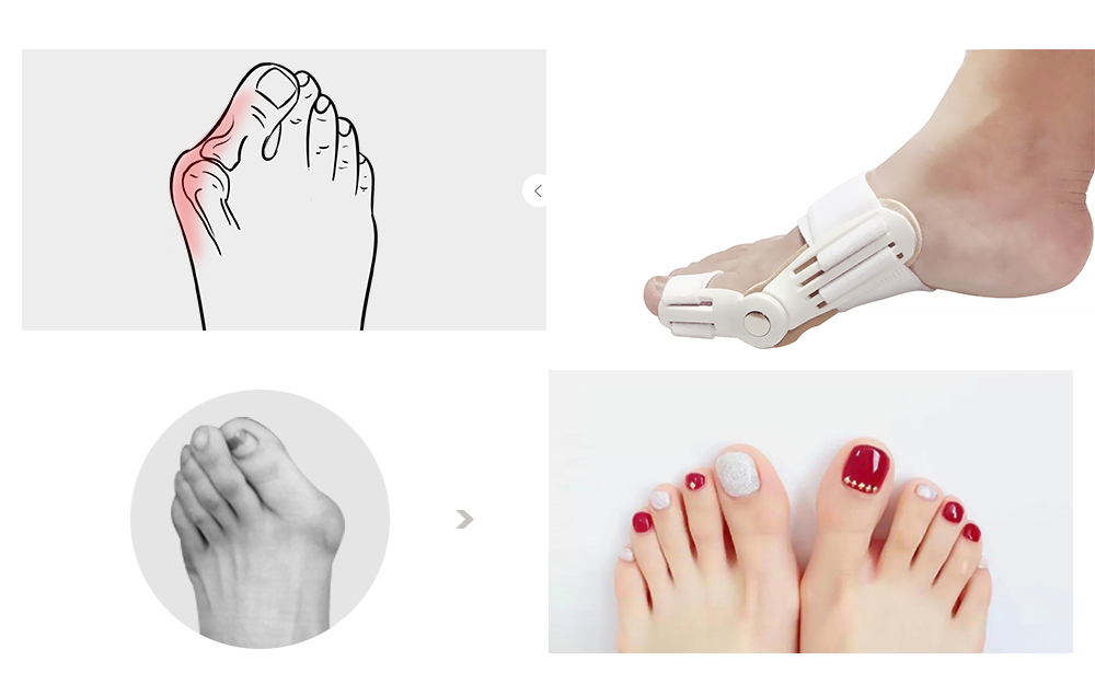 Bunion Aid Hinged Splint Toe Straightener Corrector Brace Bunion Aid Hinged Splint Toe Straightener Corrector Brace